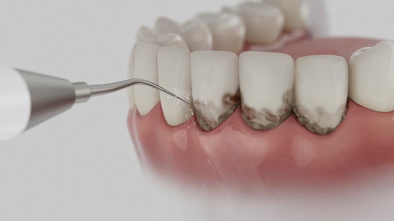 Trusted Teeth Cleaning And Checkup service in Beckley, WV - Dentist Open Now